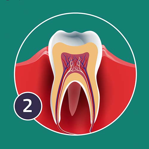 A diagram showing the impact of chronic periodontis