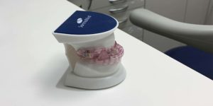 Sonomed Mandibular Advancement Device